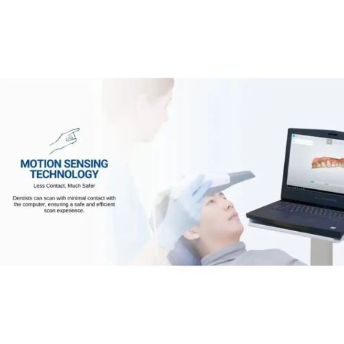 Shining 3D Aoralscan Lync (5) Shining 3D Aoralscan Lync (5)